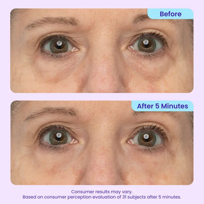 Lumora Eye Gel
