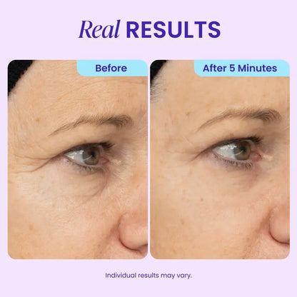 Lumora Eye Gel